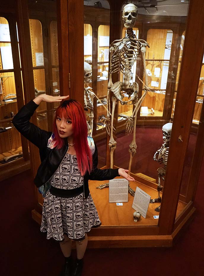 Mütter Museum of The College of Physicians of Philadelphia - The photograph  from earlier, shown again on the left, is the skeleton of a woman who wore  a corset that caused deformation